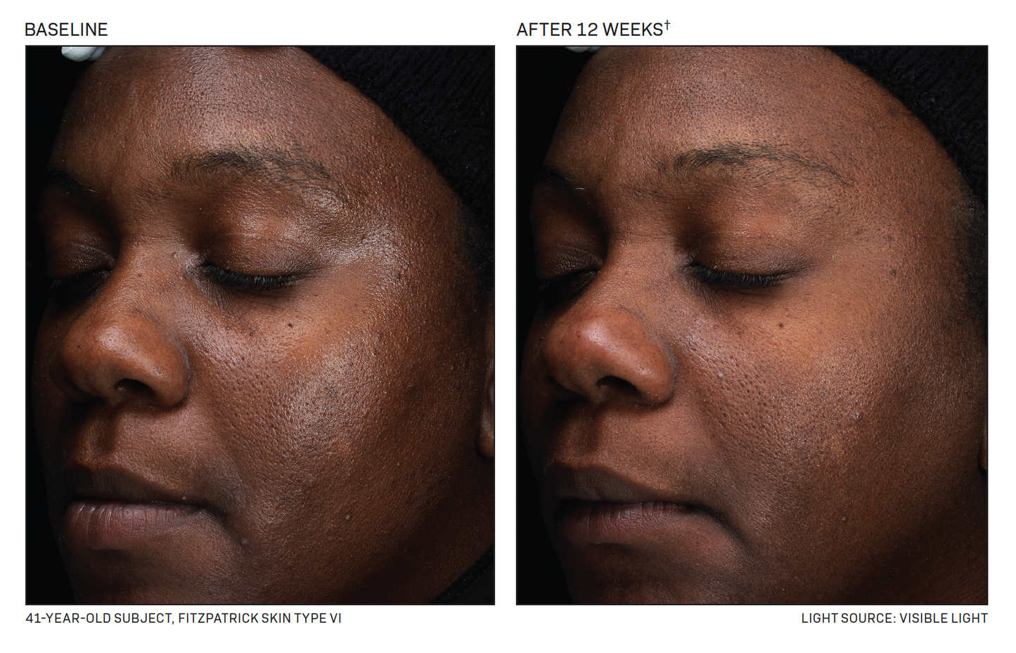 Revision DEJ Daily Boosting Serum