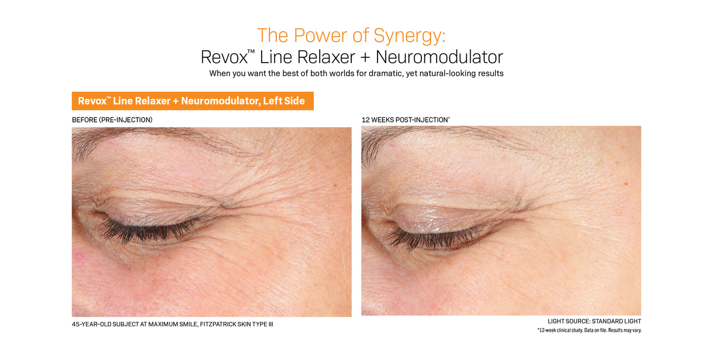 Revox Line Relaxer